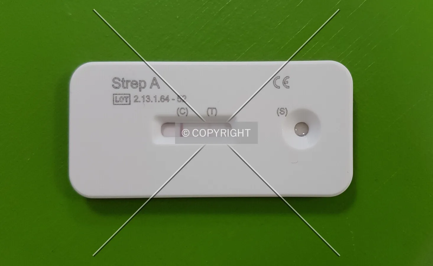 A positive Streptococcus A test