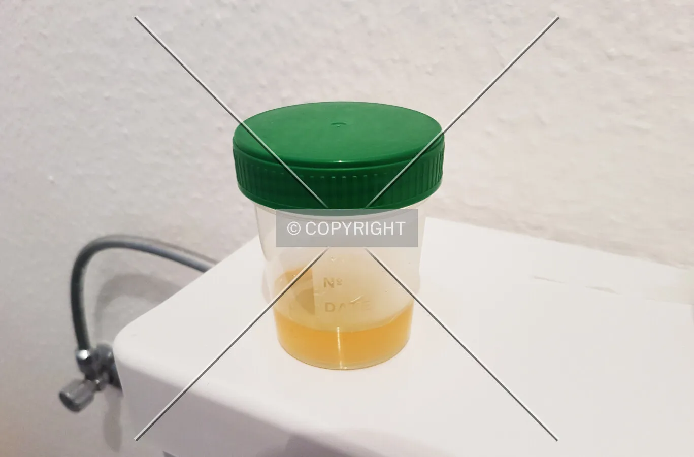 An urine sample
